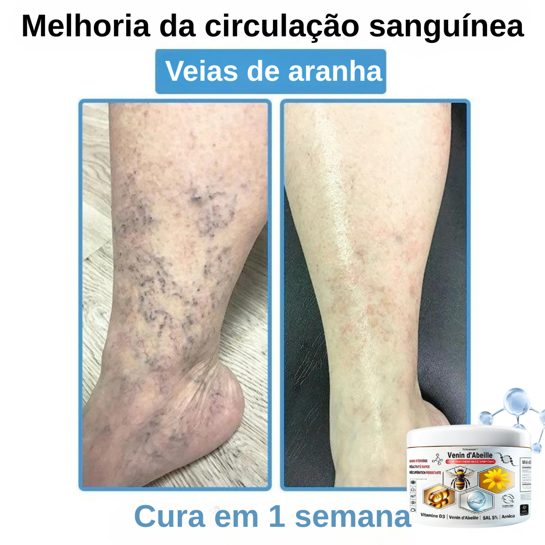 Creme anti-inflamatório multi-sintomas com veneno de abelha (OFERTA 2X1)