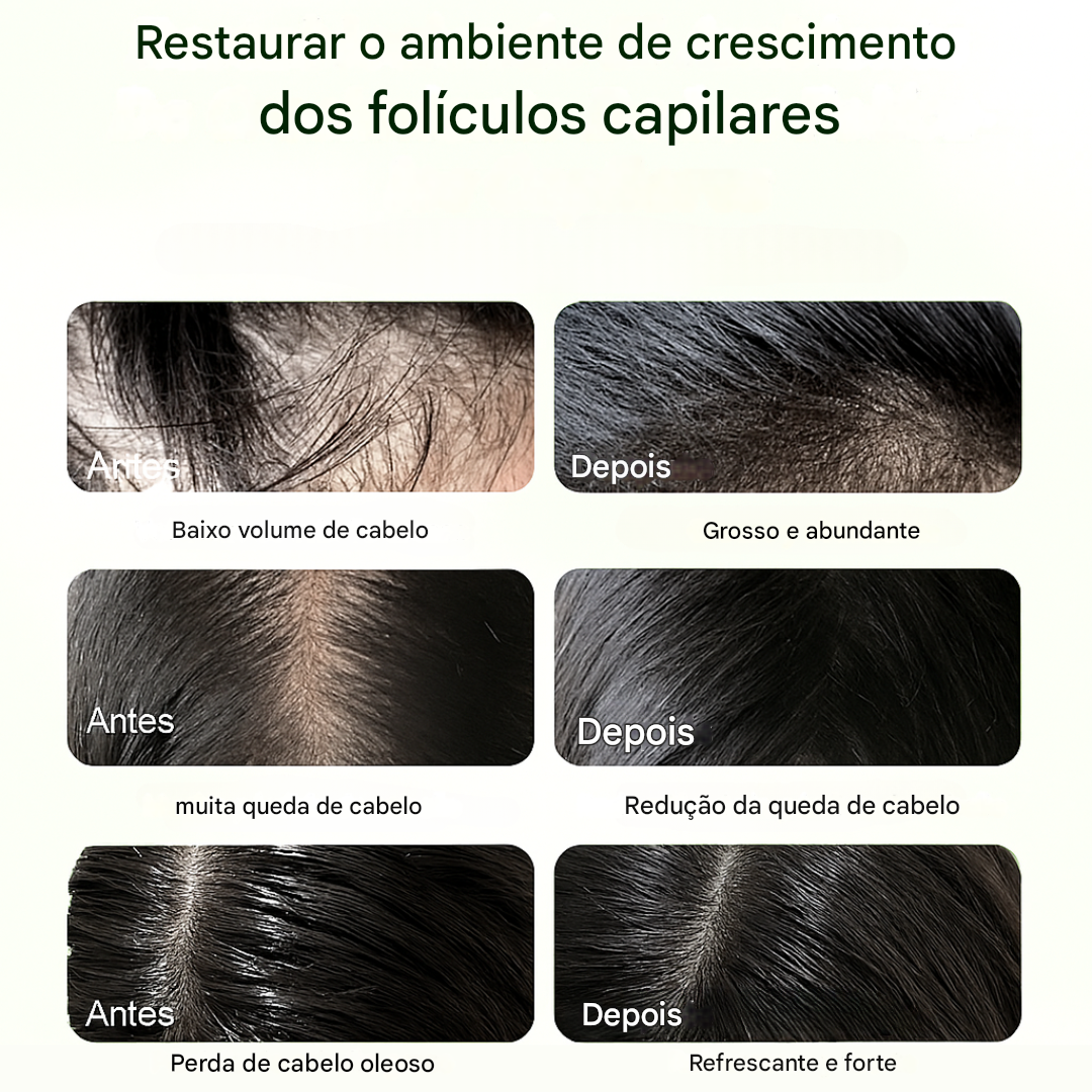 Champô Nutritivo com Batata Doce e Óleo de Alecrim 300 Ml (OFERTA 2X1)