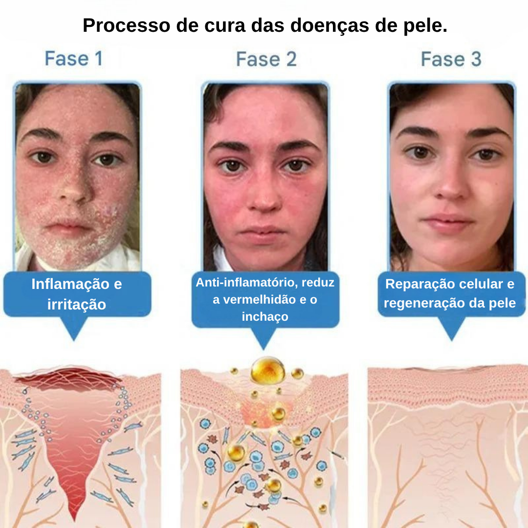 Creme anti-inflamatório multi-sintomas com veneno de abelha (OFERTA 2X1)