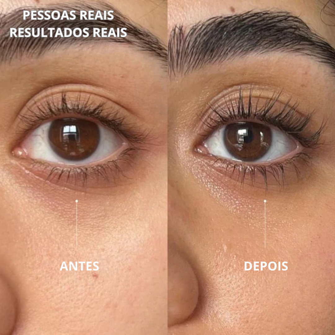 Sérum Para Crescimento dos Cílios (EM PROMOÇÃO 2X1)